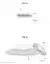 Fig. 04 - TONGUE CLEANER AND METHOD FOR MANUFACTURING THE SAME