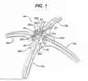 Fig. 02 - METHODS AND DEVICES FOR MECHANICAL SPACE CREATION AT A SURGICAL SITE