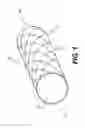 Fig. 02 - Coil anchor systems and methods of use
