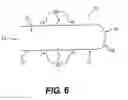 Fig. 07 - Coil anchor systems and methods of use