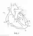Fig. 02 - METHOD FOR PROVIDING SURGICAL ACCESS