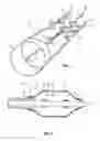 Fig. 02 - STENT MOVEMENT PREVENTING DEVICE