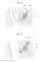 Fig. 06 - Medical stent
