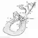 Fig. 01 - HEART VALVE REPAIR APPARATUS AND METHODS