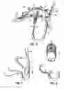 Fig. 04 - HEART VALVE REPAIR APPARATUS AND METHODS