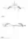Fig. 03 - Cornea implant