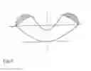 Fig. 04 - Cornea implant