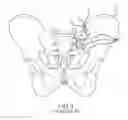 Fig. 02 - Systems for and methods of fusing a sacroiliac joint