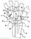 Fig. 01 - Method and apparatus for wrist arthroplasty