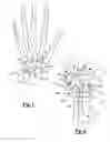 Fig. 02 - Method and apparatus for wrist arthroplasty