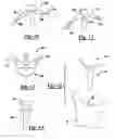Fig. 07 - Method and apparatus for wrist arthroplasty