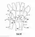 Fig. 22 - Method and apparatus for wrist arthroplasty