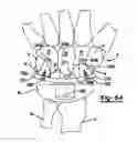 Fig. 35 - Method and apparatus for wrist arthroplasty