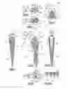 Fig. 02 - Hip prosthesis