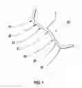 Fig. 02 - Prosthetic joint assembly and  joint member therefor