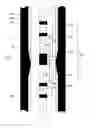 Fig. 01 - Method and apparatus for removal of the double indication of defects in remote eddy current inspection of pipes