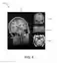 Fig. 05 - Predicting user interactions during image processing