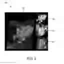 Fig. 06 - Predicting user interactions during image processing