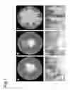 Fig. 02 - REGULATORS INVOLVED IN MUSHROOM FORMATION