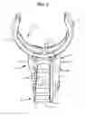 Fig. 06 - Rail accessory mounting apparatus for weapon