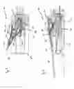 Fig. 04 - Field gun
