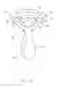 Fig. 04 - Eyelash curler