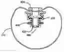 Fig. 01 - Filter cleaning apparatus