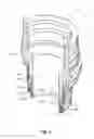 Fig. 04 - Expandable anchoring mechanism