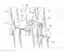 Fig. 01 - Device for spacing electrical harnesses in a turbomachine