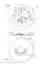 Fig. 02 - Ametropia progression indicating device