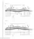 Fig. 01 - Ultrasonic transducer, ultrasonic transducer array, and ultrasonic device