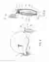 Fig. 06 - Earphone mounting structure