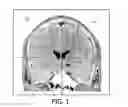 Fig. 02 - Visualizing surgical trajectories