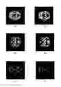 Fig. 01 - Method and system for segmenting a brain image
