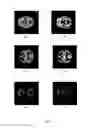 Fig. 08 - Method and system for segmenting a brain image