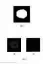 Fig. 09 - Method and system for segmenting a brain image