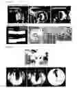 Fig. 06 - In situ forming hydrogel and biomedical use thereof