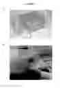 Fig. 02 - COMPOSITIONS AND METHODS OF TREATING NO-OPTION CRITICAL LIMB ISCHEMIA (CLI)