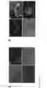 Fig. 19 - Regionalised endoderm cells and uses thereof
