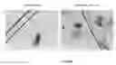 Fig. 35 - Neuron generation, regeneration and protection