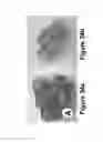 Fig. 26 - Methods of and compositions for inhibiting the proliferation of mammalian cells