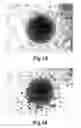Fig. 08 - Therapeutic Agent