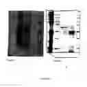 Fig. 03 - Compositions and methods for treatment of microbial infections
