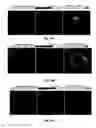 Fig. 19 - Attenuation of encephalitogenic alphavirus and uses thereof