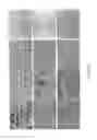 Fig. 04 - REGENERATION OF TISSUE WITHOUT CELL TRANSPLANTATION