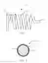 Fig. 02 - COATINGS AND METHODS FOR CONTROLLED ELUTION OF HYDROPHILIC ACTIVE AGENTS