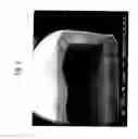 Fig. 04 - TABLET HAVING HOLLOW STRUCTURE
