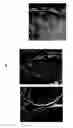Fig. 01 - Transplantation of cells expressing markers for photoreceptor cells and retinal ganglion cells induced from Müller stem cells