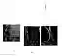 Fig. 02 - Transplantation of cells expressing markers for photoreceptor cells and retinal ganglion cells induced from Müller stem cells