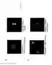 Fig. 04 - Transplantation of cells expressing markers for photoreceptor cells and retinal ganglion cells induced from Müller stem cells